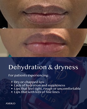 Before and After Picture of Dehydrated lips treated by Amiko Tulip